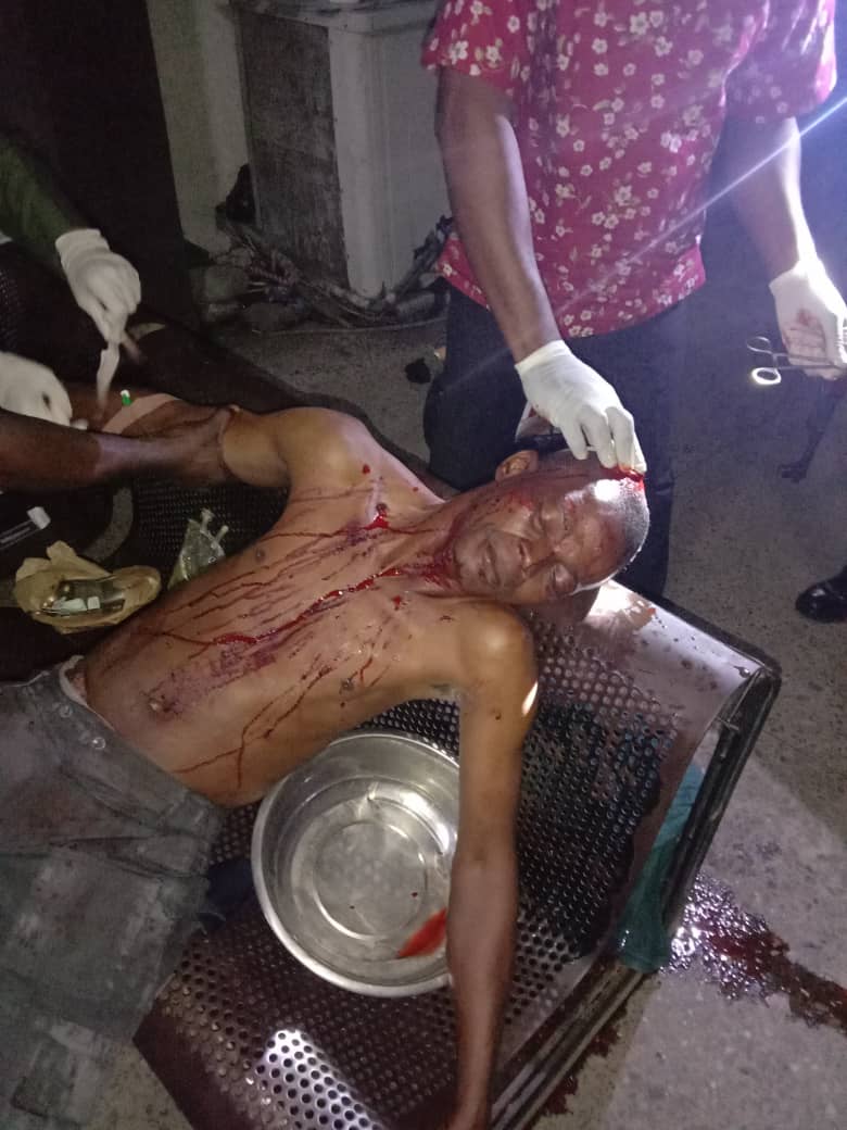 Again, smugglers machete Customs officer over seized rice in Ogun