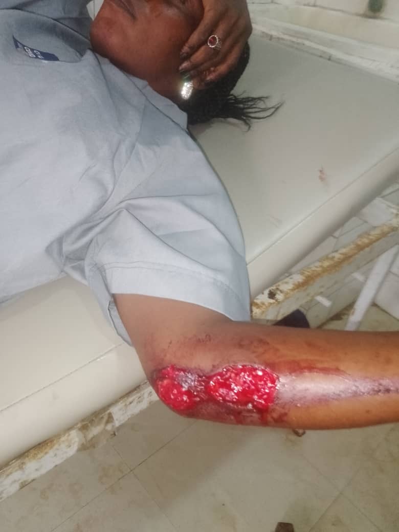 Gunmen attack five maritime workers union members in Anambra